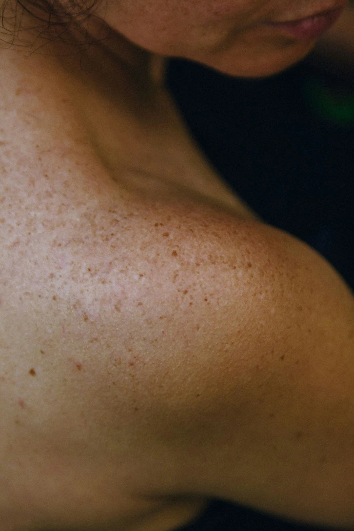 A close up of a woman with freckles on her arm